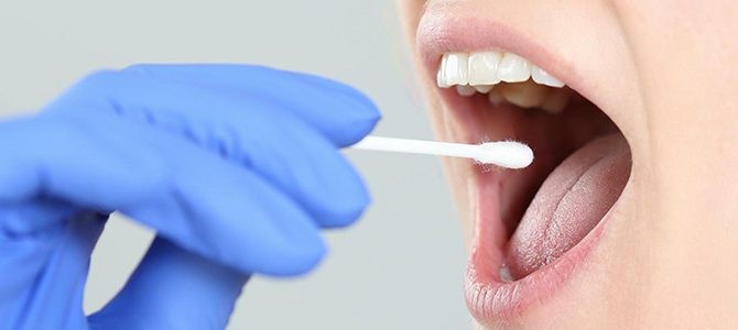 analize de carioreceptivitate davinci dental clinic
